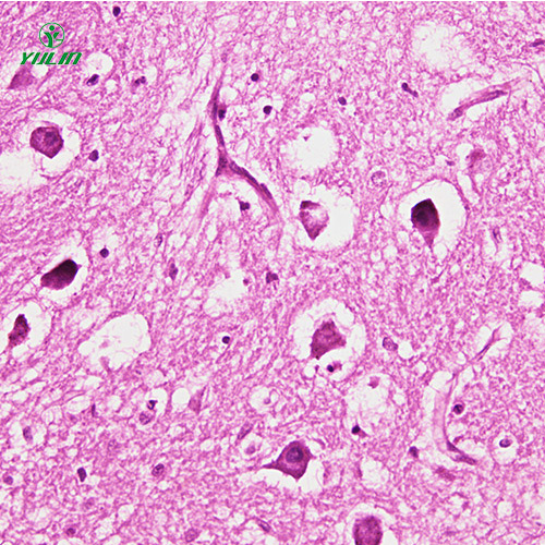 人神經(jīng)系統(tǒng)疾病標(biāo)本片