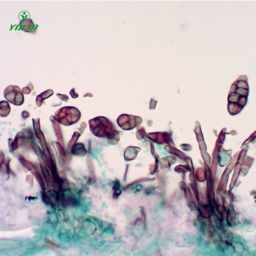 茄科植物病害玻片
