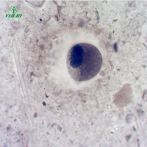 醫(yī)學(xué)寄生蟲纖毛蟲玻片